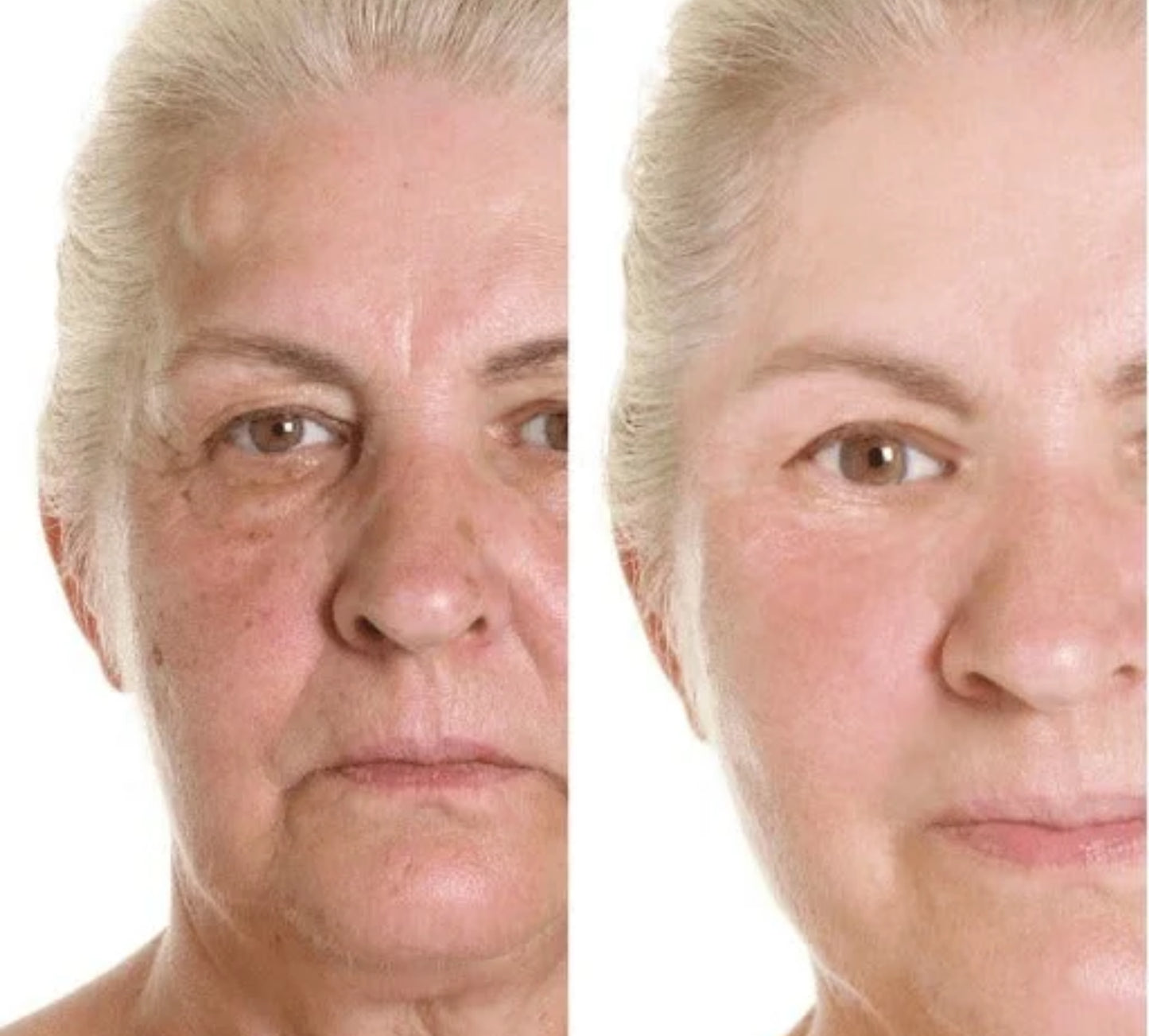 BioLift™ - Støtter hudens naturlige gjenoppretting – for færre linjer og mer fasthet, på en skånsom måte.