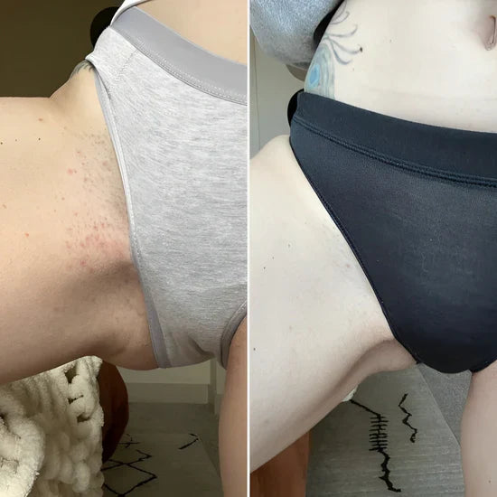 SilkCure™ - Glatt, strålende hud på bare 5 minutter