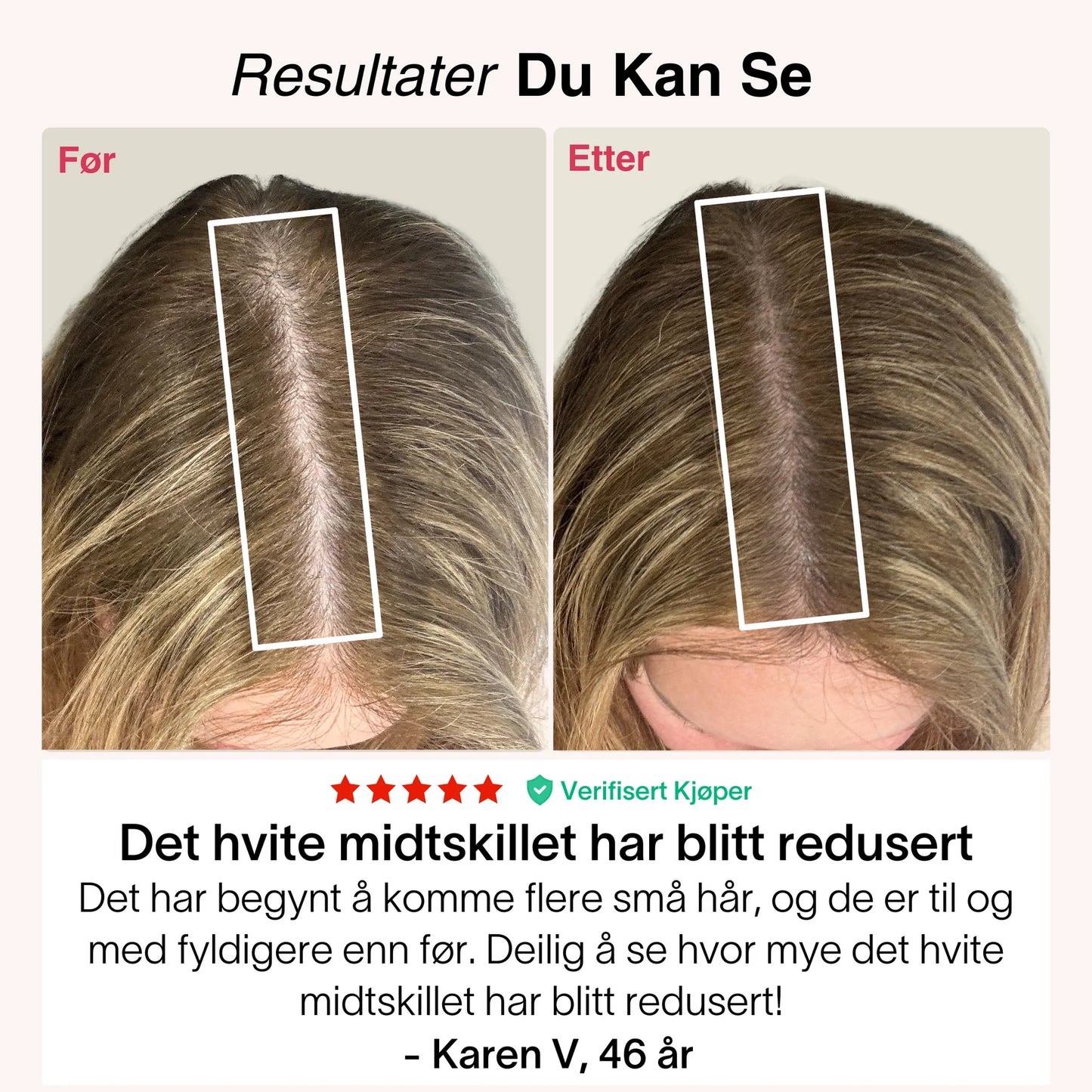 Revolux™ – Fordi ekte selvtillit starter med håret ditt