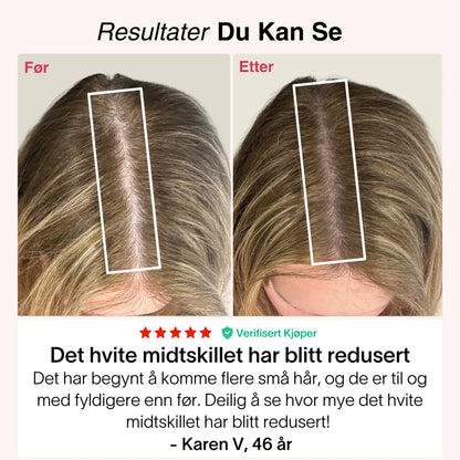 Revolux™ – Fordi ekte selvtillit starter med håret ditt