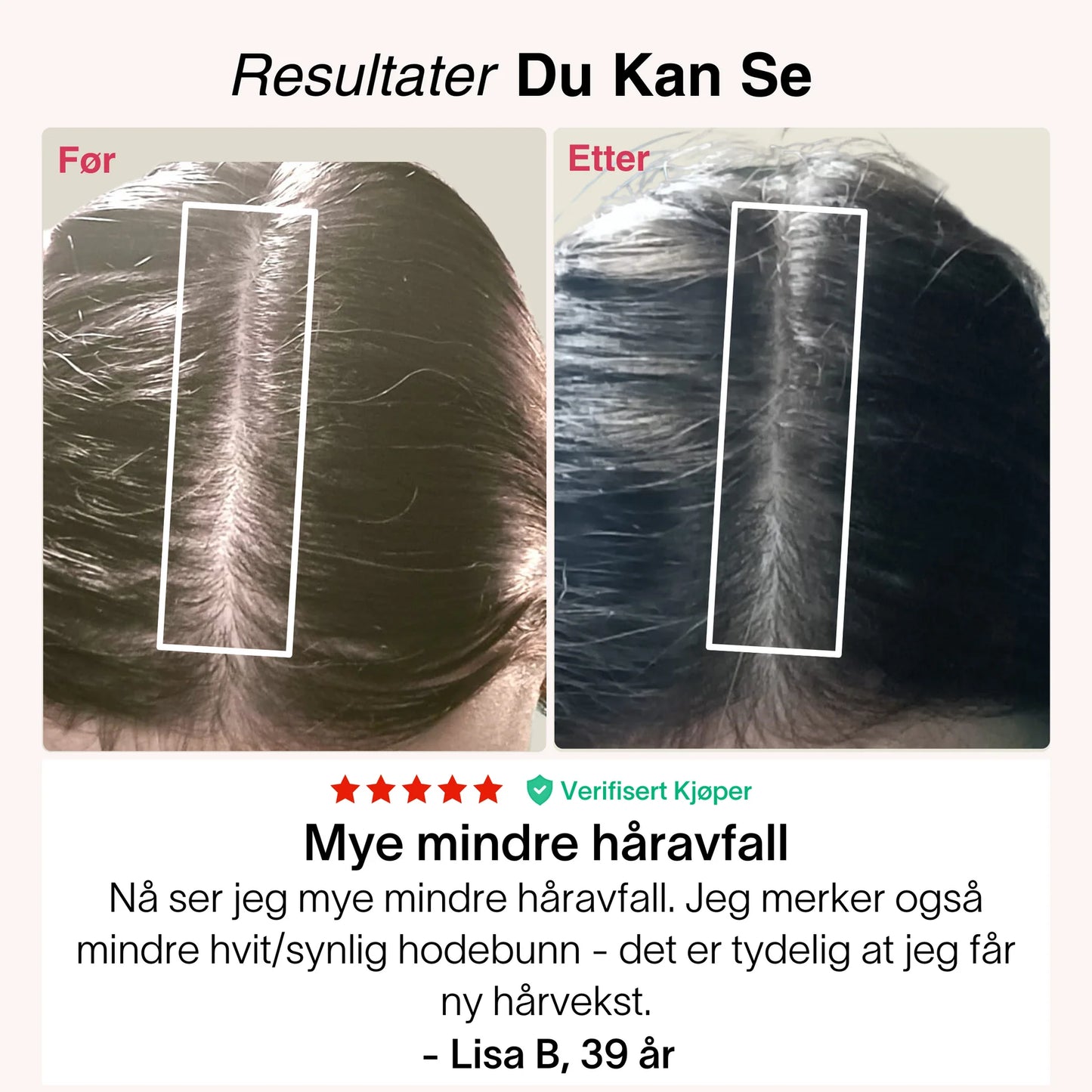 Revolux™ – Fordi ekte selvtillit starter med håret ditt