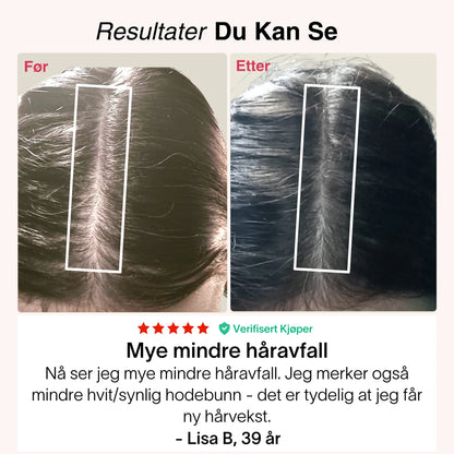 Revolux™ – Fordi ekte selvtillit starter med håret ditt