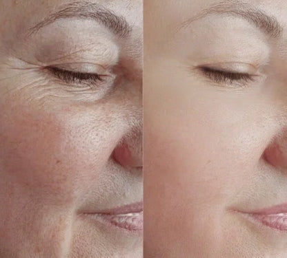 BioLift™ - Støtter hudens naturlige gjenoppretting – for færre linjer og mer fasthet, på en skånsom måte.