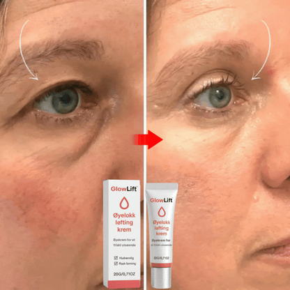 GlowLift™ - Få bort hengende øyelokk – oppdag ditt yngre jeg på 14 dager!