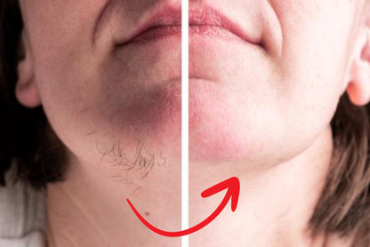 Lumessia™ - Reduserer hormonell hårvekst naturlig med opptil 92 % på bare 4 dager