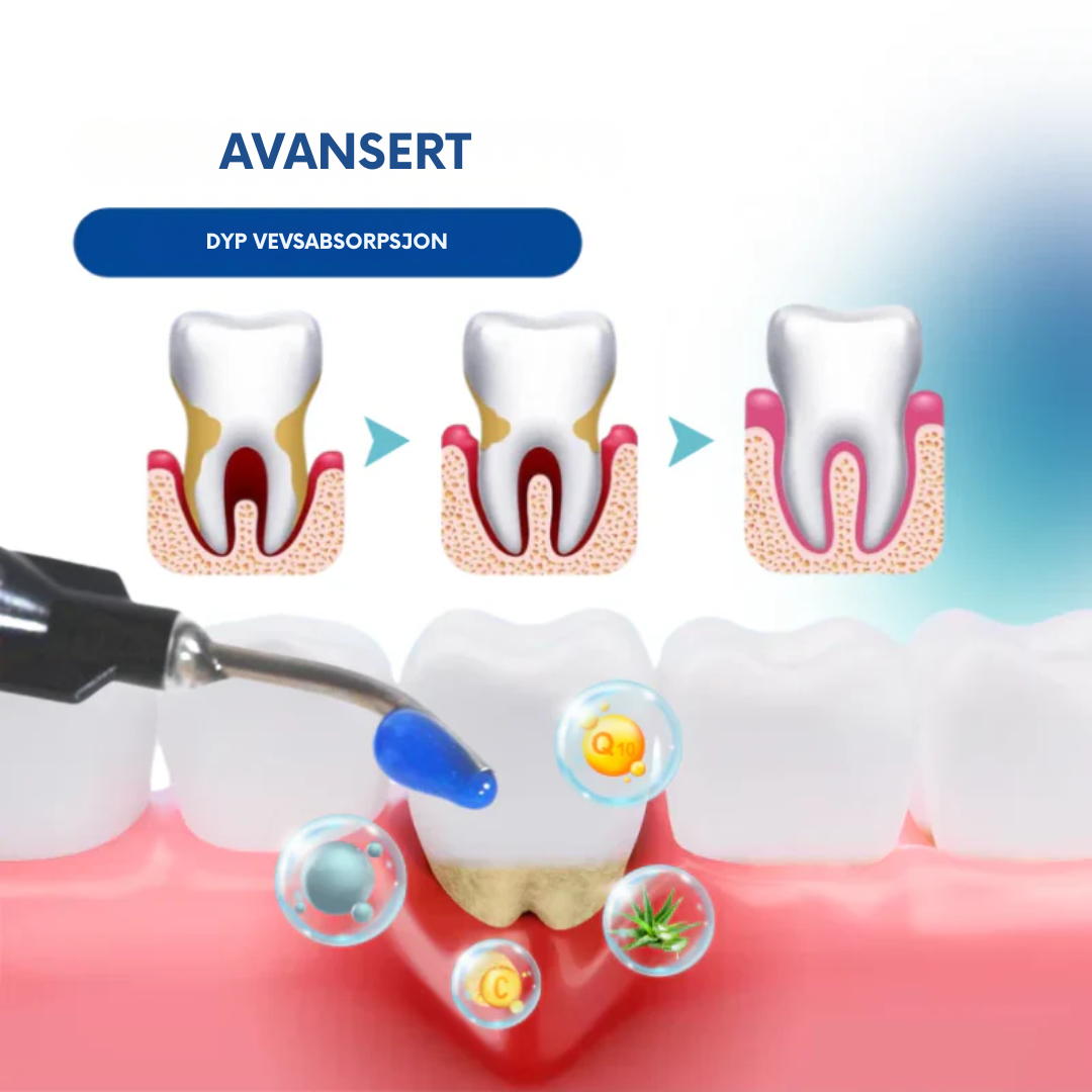 Oralglow™ -  Forhindre smerte, føl umiddelbar lindring