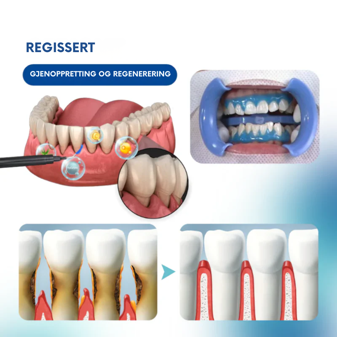 Oralglow™ -  Forhindre smerte, føl umiddelbar lindring