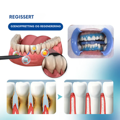 Oralglow™ -  Forhindre smerte, føl umiddelbar lindring