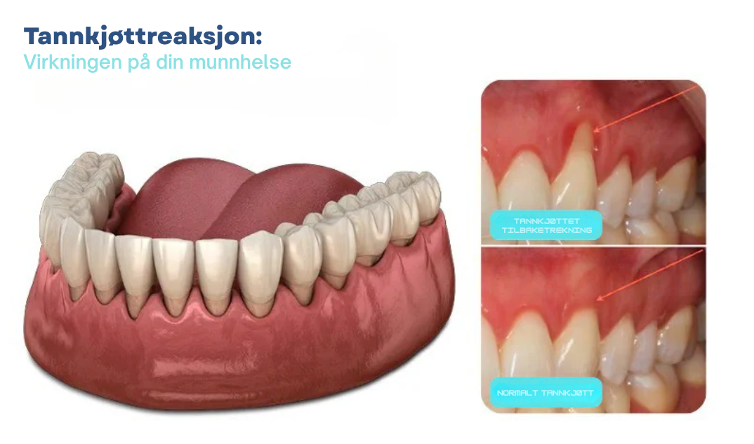 Oralglow™ -  Forhindre smerte, føl umiddelbar lindring