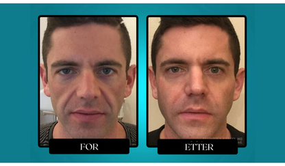 Draven™ AgeGuard Tallow Cream - Rynker bort, fasthet tilbake – rent, kraftfullt og naturlig