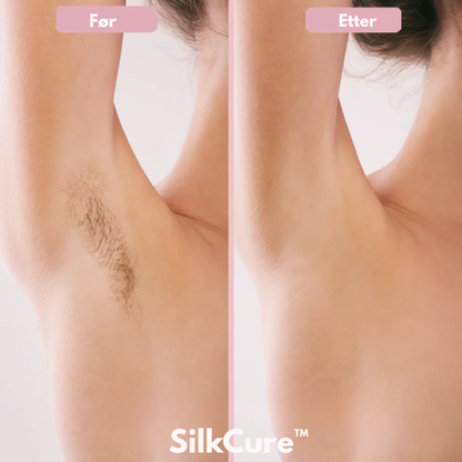 SilkCure™ - Glatt, strålende hud på bare 5 minutter