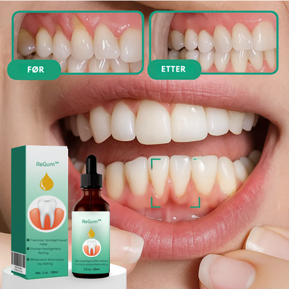 ReGum™- Sunn tannkjøtt. Et liv uten smerter.