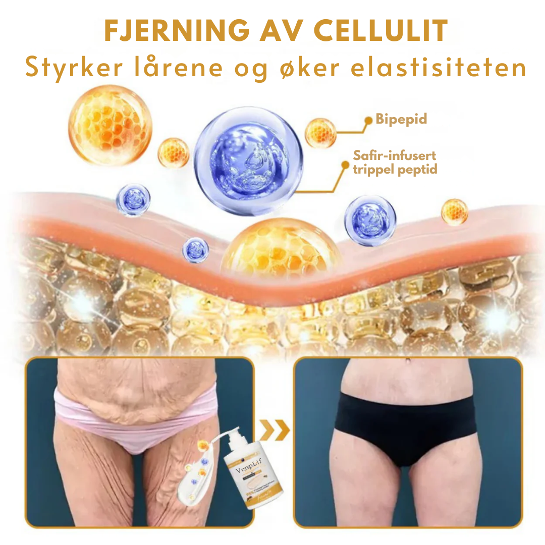 VenoLift™ – Strammere hud. Glattere konturer. Gjenvunnet selvtillit.