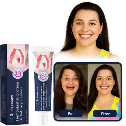 SmileSecure™ – For et smil som vare